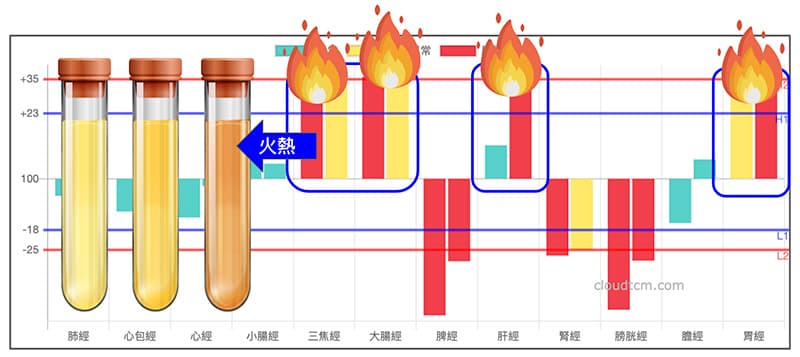 夏季常見的經絡型態，尿液容易呈現深黃色