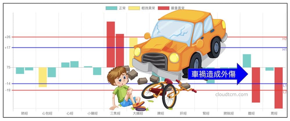 外傷會造成特定的經絡現象