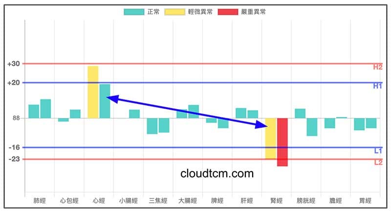 平和經絡型態，出現心經實證，腎經虛證