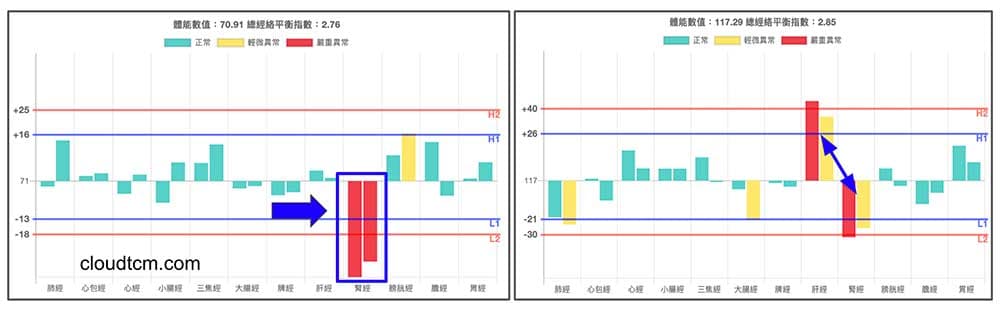 平和經絡型態，出現腎經異常相關現象