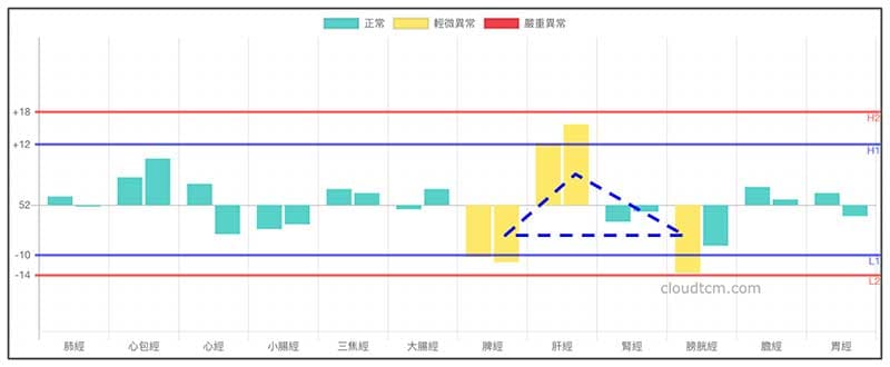 經絡圖暗藏鐵三角經絡型態