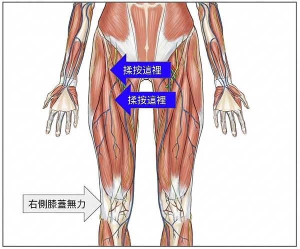 右膝蓋感到無力的阿是穴