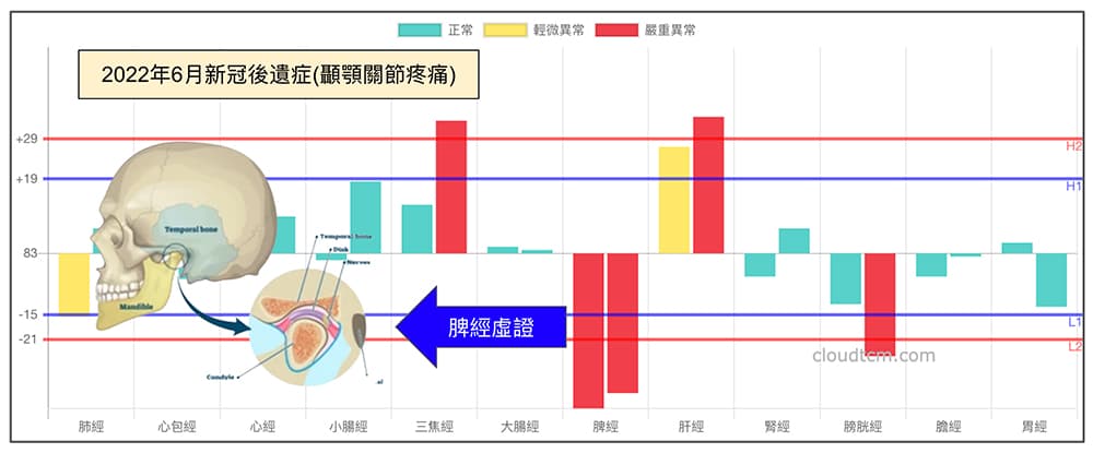 新冠痊癒之後的兩天，出現顳顎關節疼痛