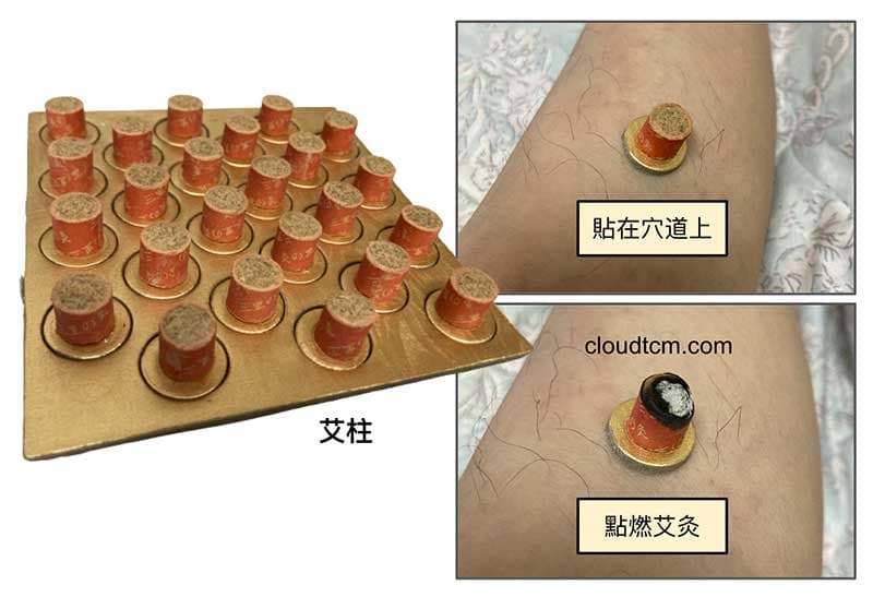 日本韓國流行的艾柱