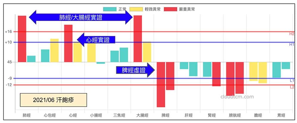 汗皰疹經絡現象