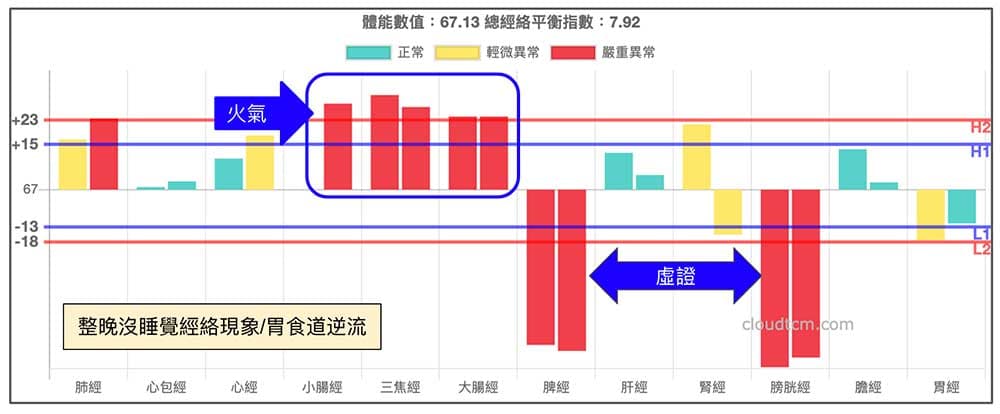 熬夜沒睡覺之後造成胃食道逆流