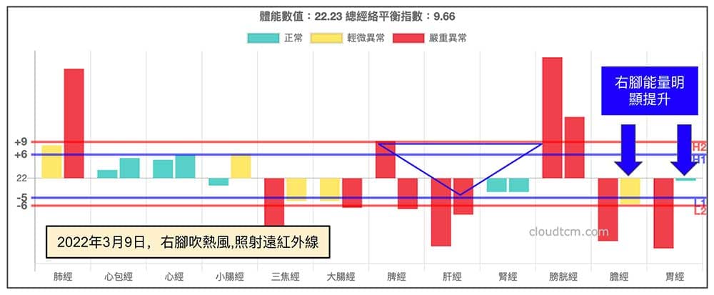 熱療右腳疼痛部位後，右腳陽經能量明顯提升