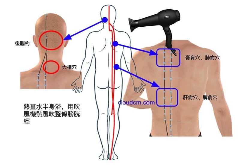 膀胱經進行熱療，可以提升免疫力