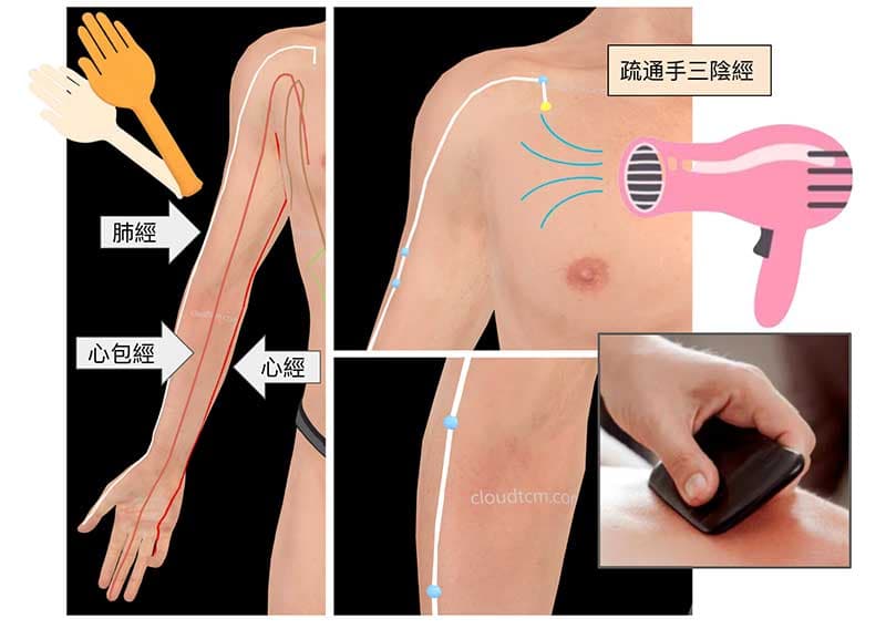 運用按摩、拍打、刮痧、熱療疏通手三陰經