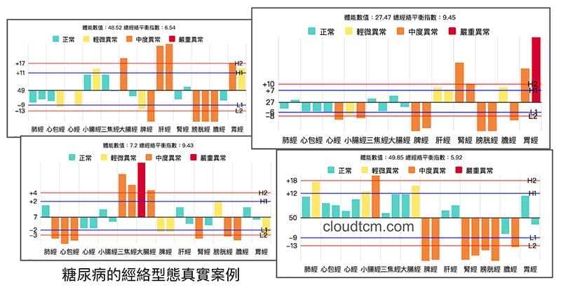 糖尿病的真實經絡型態案例，鐵三角類型