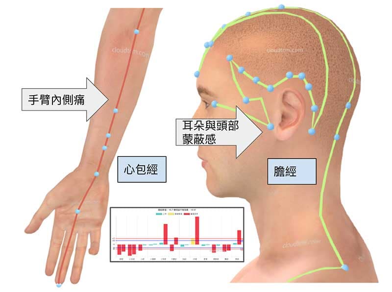 從經絡理解症狀是相對容易的