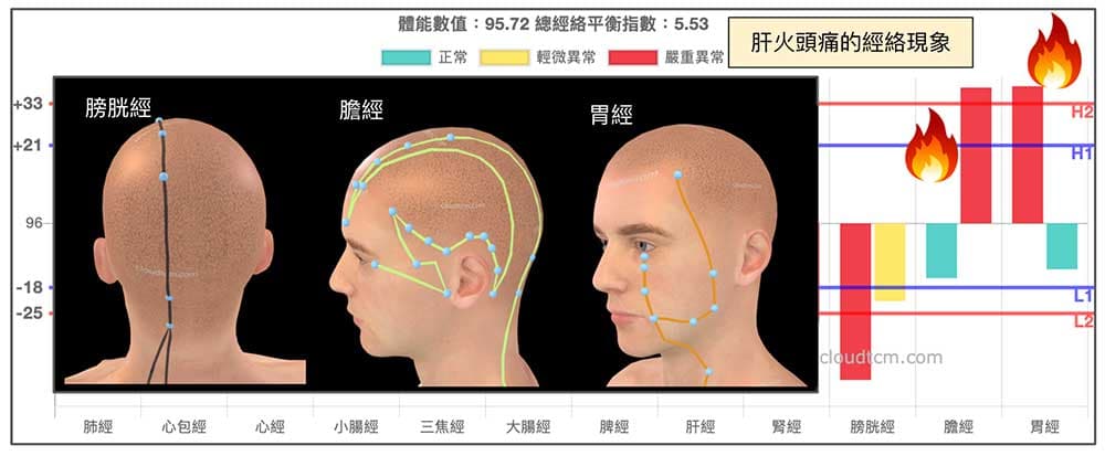 肝火造成頭痛暈眩的主要經絡現象