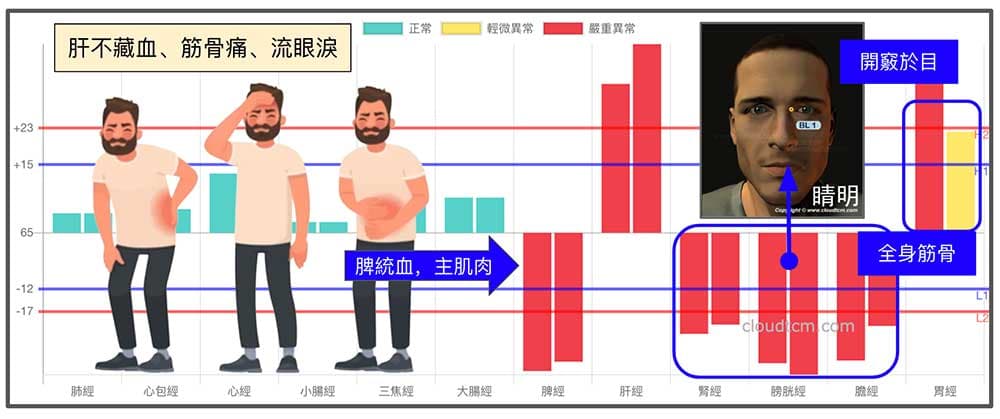 鐵三角經絡型態合理解釋肝藏血，主筋骨，開竅於目