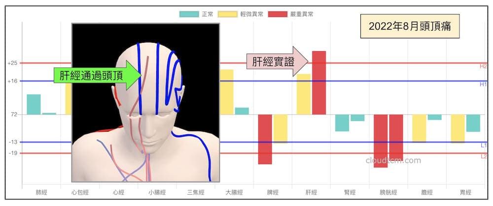 透過肝經分支來理解肝經異常的頭頂痛