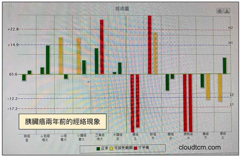 胰臟癌經絡現象