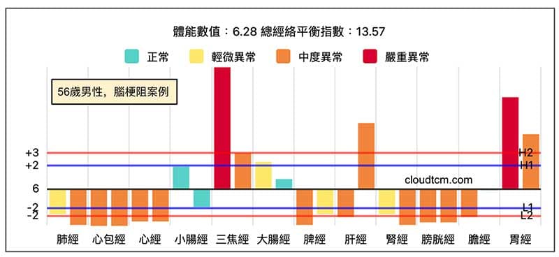 腦梗阻案例