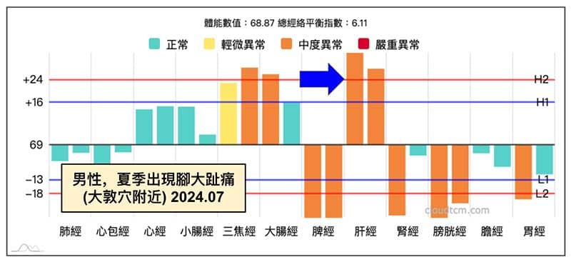 男性出現腳大趾痛，在夏季常出現的經絡型態