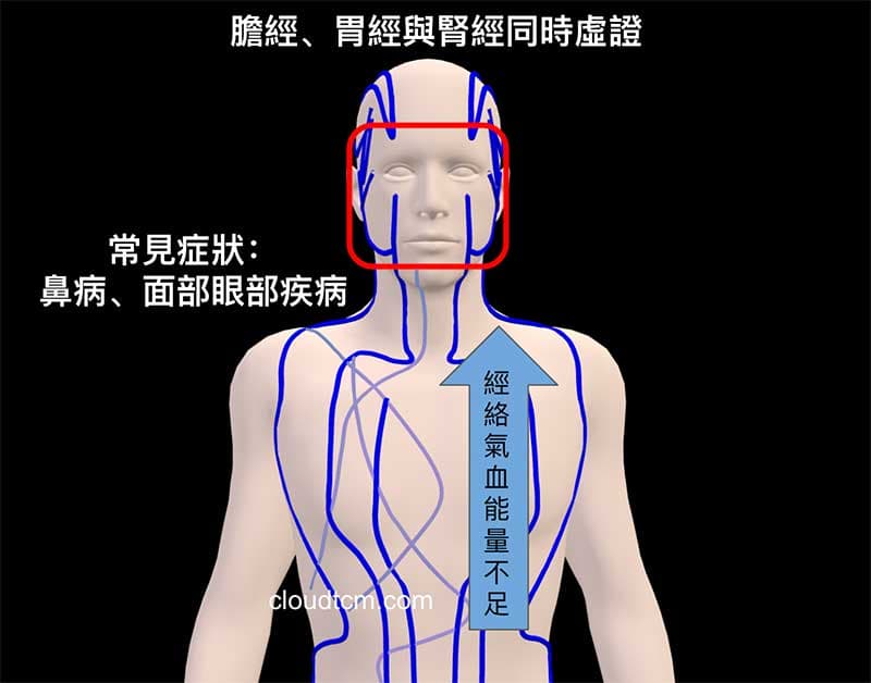 膽胃腎經虛證，容易出現鼻病及眼面部疾病