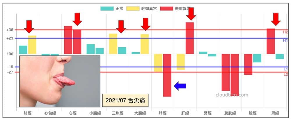 舌頭痛案例