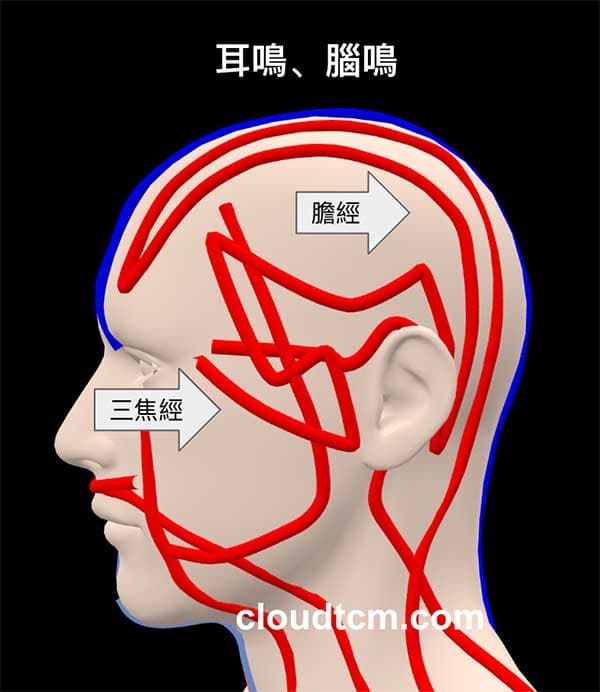 鐵三角經絡型態容易出現耳鳴腦鳴