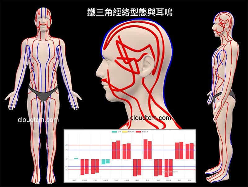 鐵三角經絡型態變化型容易出現耳鳴