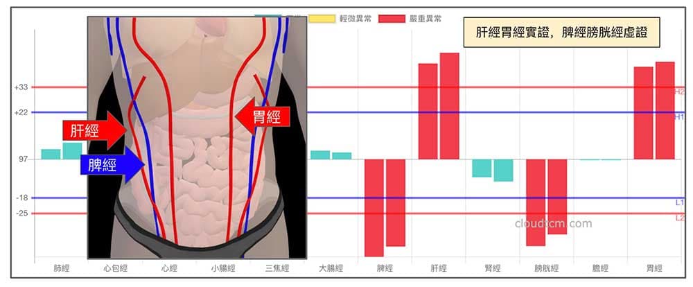 長期熬夜或過度疲勞時，出現排便異常的經絡型態