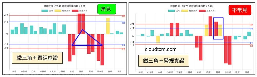 鐵三角經絡型態，有時候會出現腎經實證