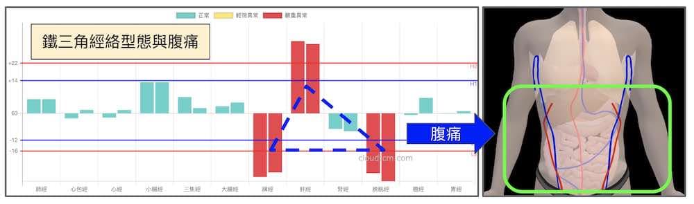 鐵三角經絡型態容易出現腹痛，腸道疾病