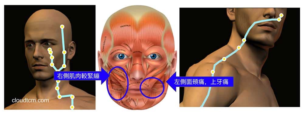 陽明經異常出現面部與上牙齒痛