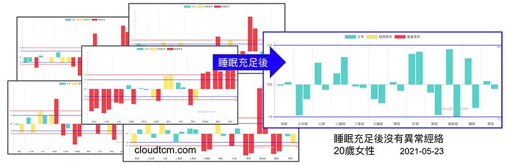 居家隔離睡眠充足
