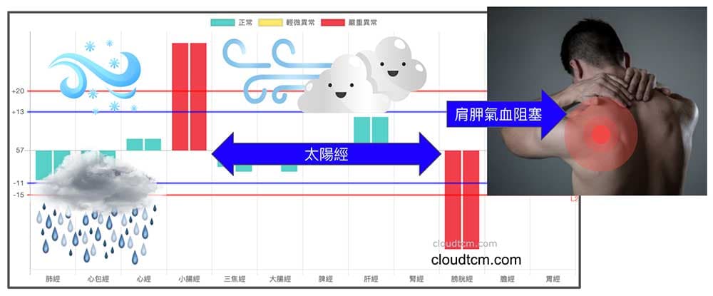 外感風寒濕出現肩胛部位阻塞