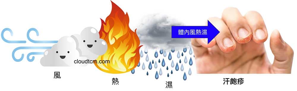 風熱濕汗皰疹