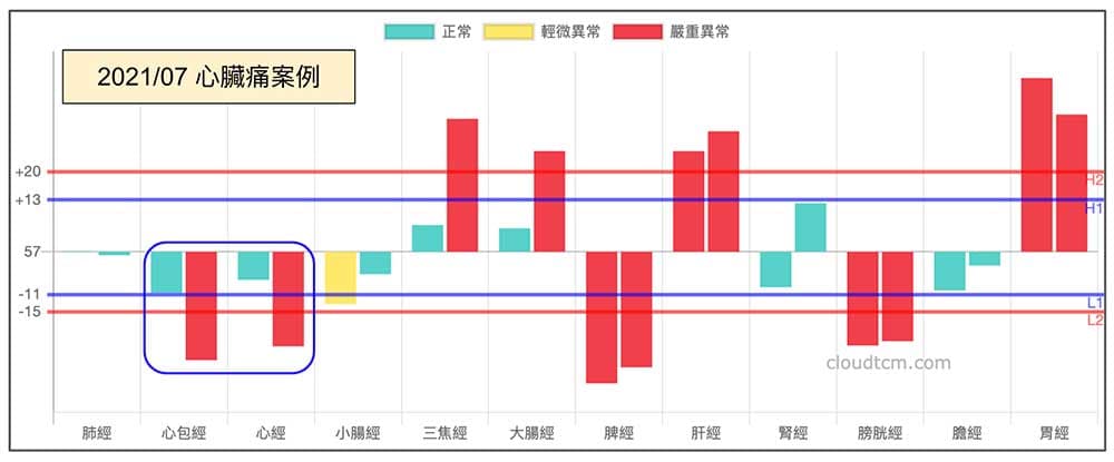 夏季心臟痛案例