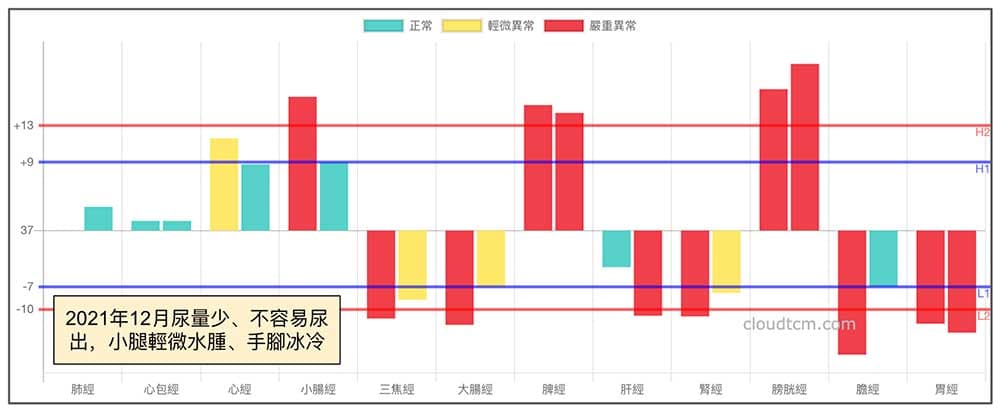 2021年冬天出現尿少，小腿輕微水腫現象