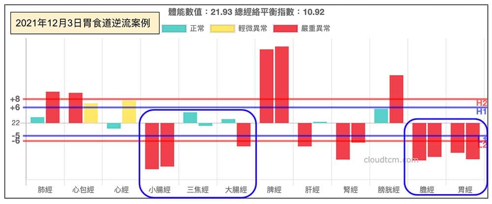 2021年12月冬季出現胃食道逆流案例