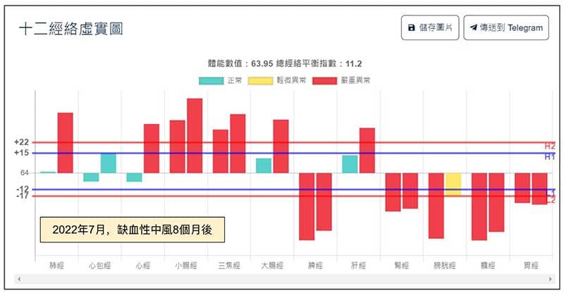 缺血性中風8個月後的經絡現象