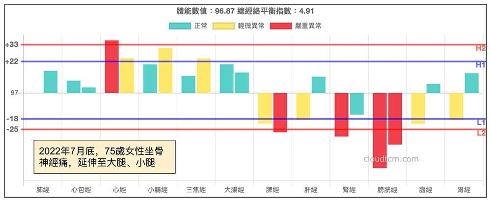 2022年7月底，75歲女性坐骨神經痛復發