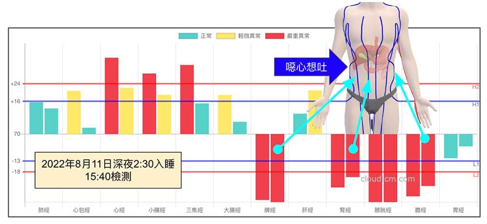 第二天繼續熬夜，隔天出現噁心嘔吐現象