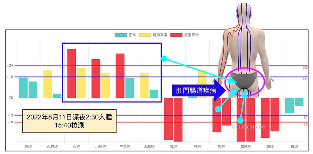 熬夜後出現腹瀉、腹痛與肛門痛