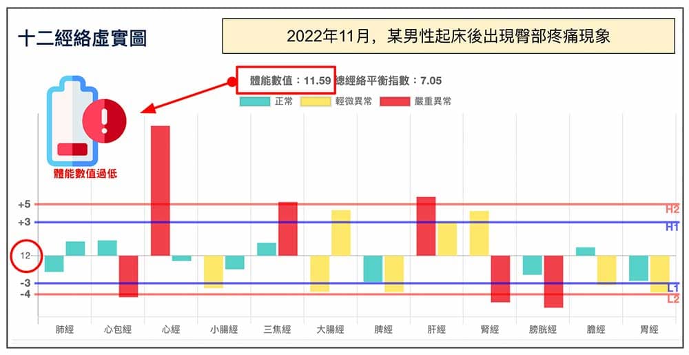 2022年11月一大早起床出現臀部疼痛案例