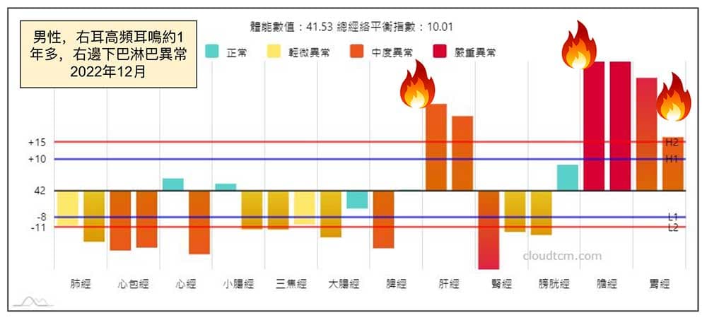 男性右耳出現高頻耳鳴持續一年多的經絡型態