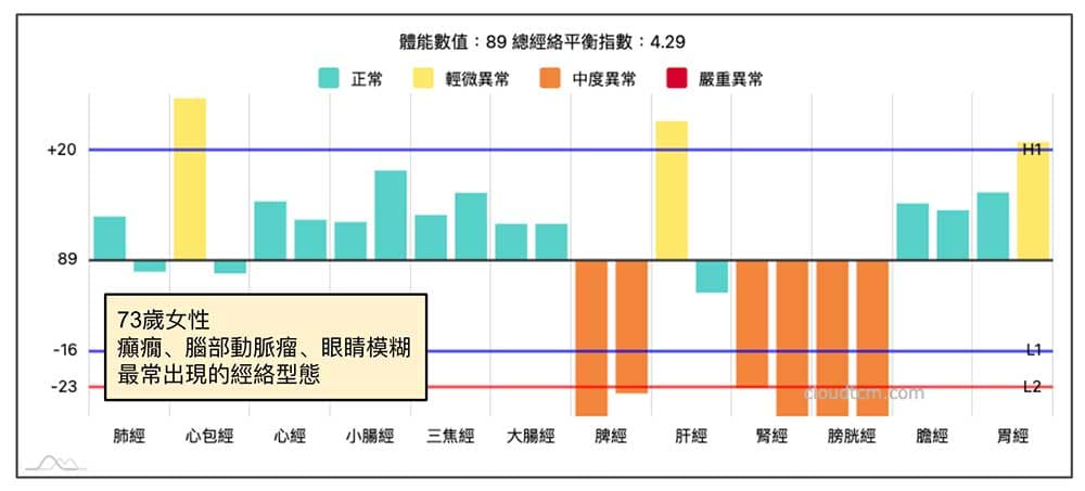 腦部動脈瘤真實案例
