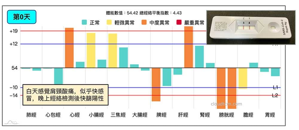 新冠確診第0天快篩陽，當時的經絡型態