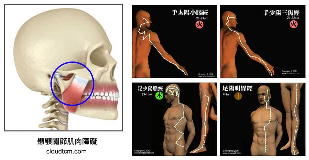 造成顳顎關節症候群的四條經絡(小腸經、三焦經、胃經與膽經)