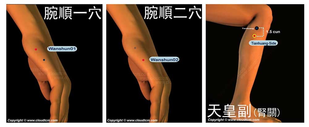 董氏奇穴的許多穴位，其實與十二經絡穴道類似