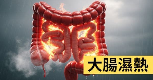 大腸濕熱