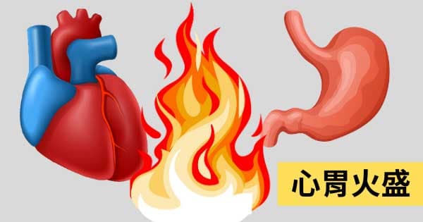 心胃火盛
