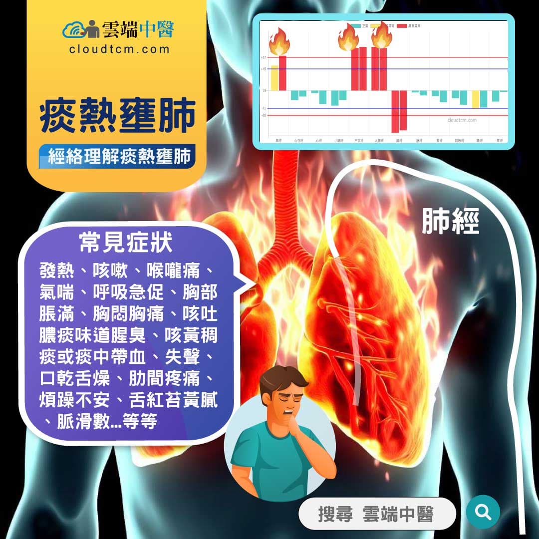 痰熱壅肺經絡圖