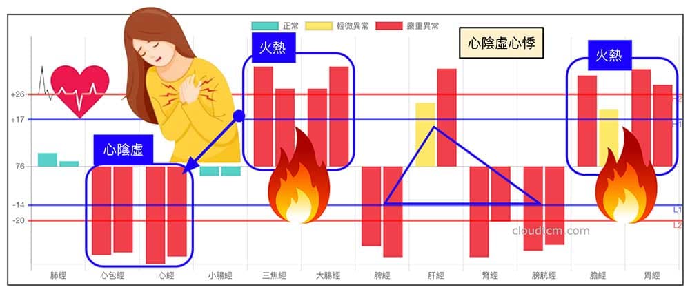 鐵三角經絡體質，很容易出現心陰虛心悸