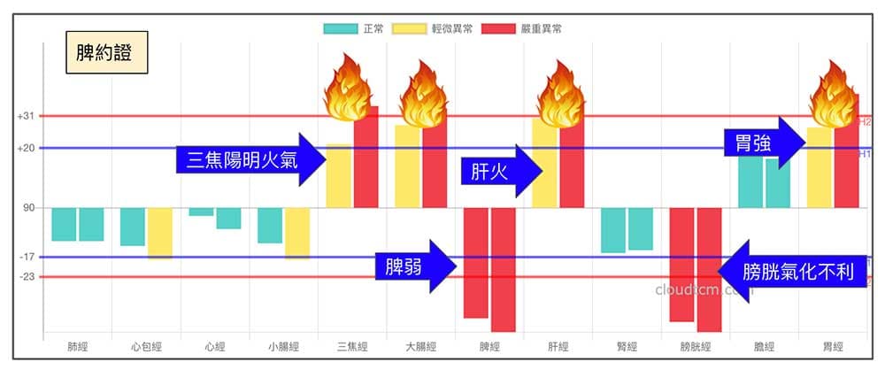 脾約證的經絡型態，就是常見的鐵三角經絡型態